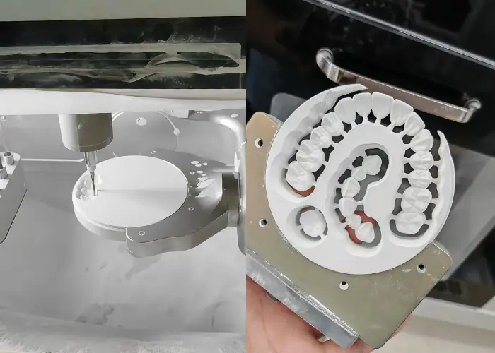 CNC machining of zirconia denture blocks and semi-finished dental parts for medical applications